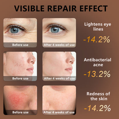 Photon Therapy Red Light Facial Mask